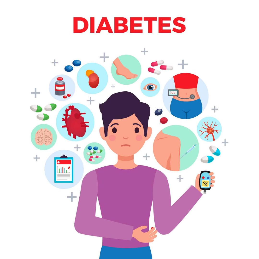 Understanding Maturity-Onset Diabetes of the Young (MODY)