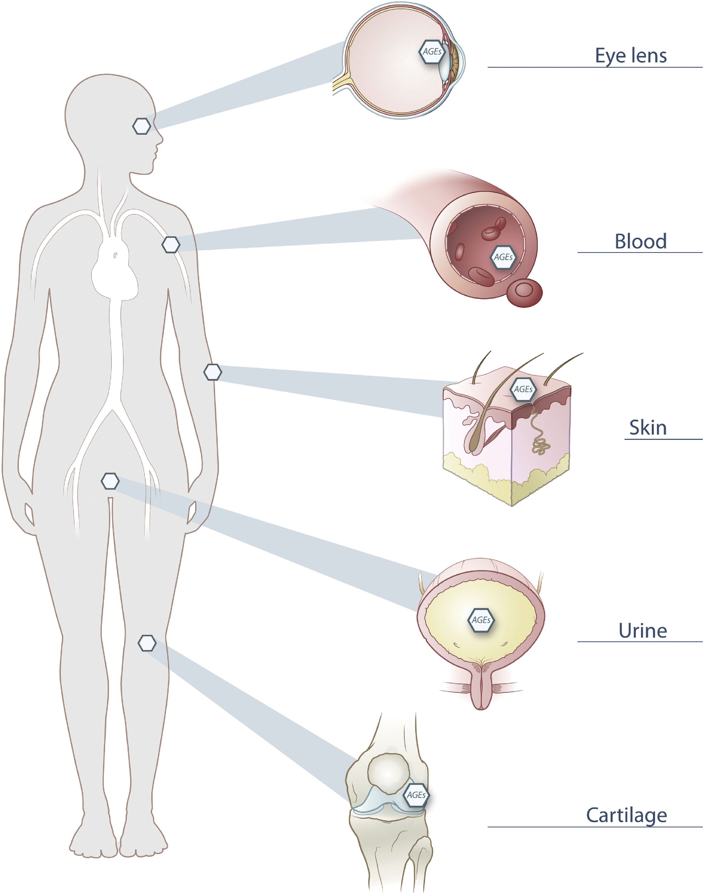 Have you ever heard of glycation end products?