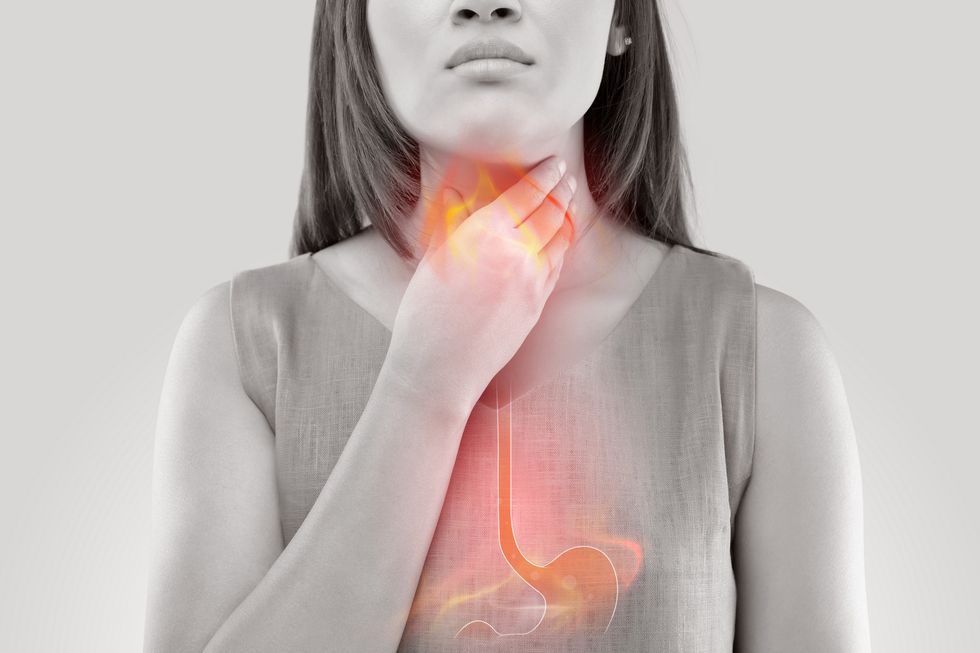 Obese people are more susceptible to gastroesophageal reflux