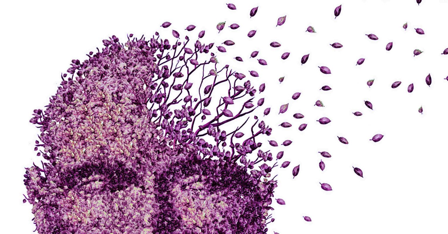Getting rid of obesity can also prevent dementia